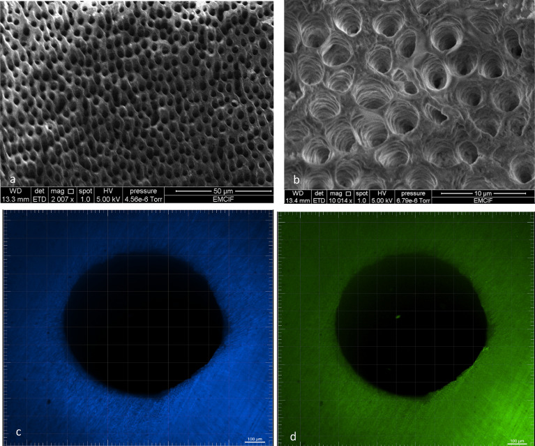 Illustrative image of GWS treatment