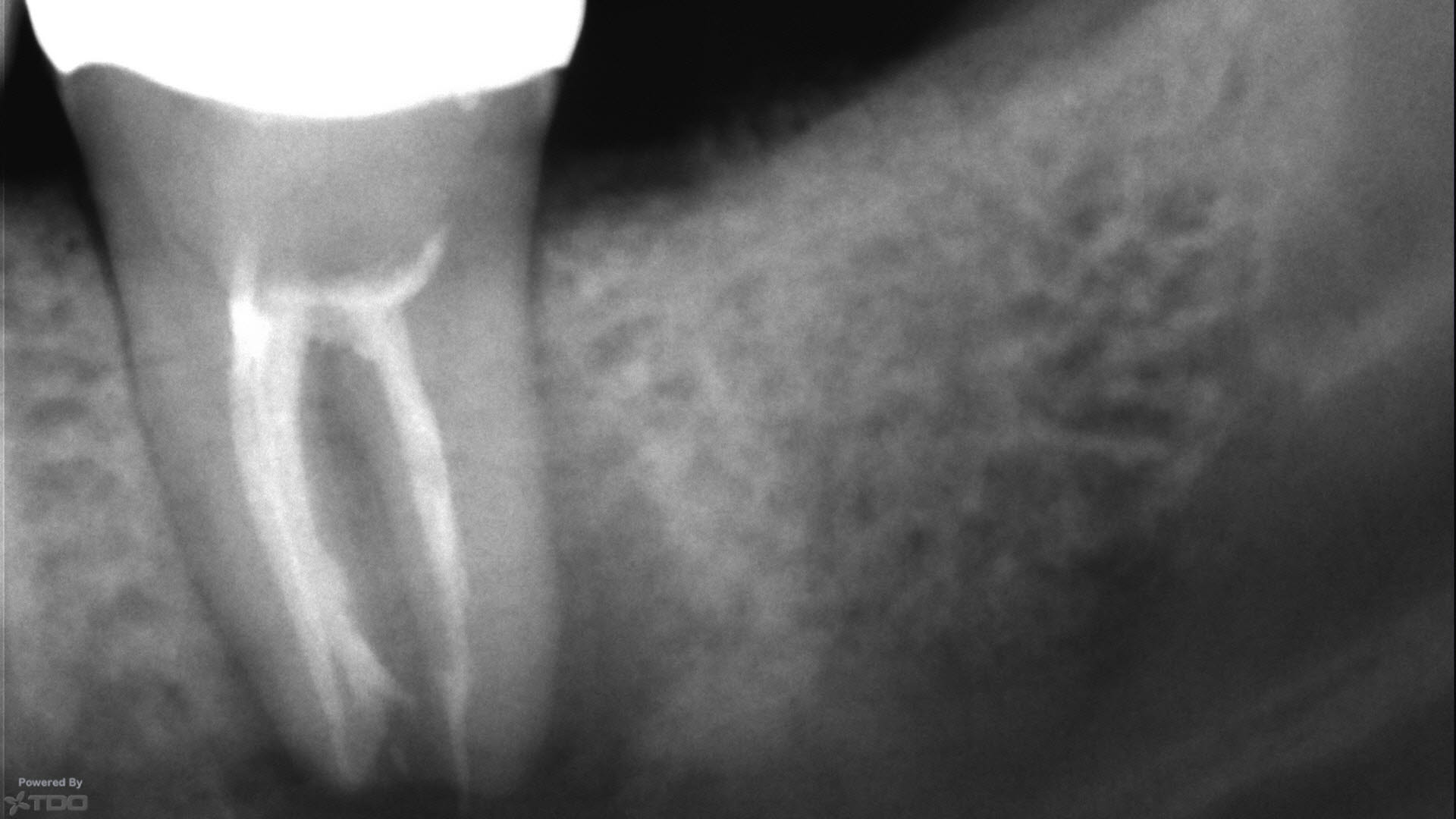 Pre-Op