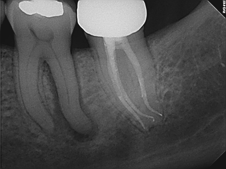 Pre-Op
