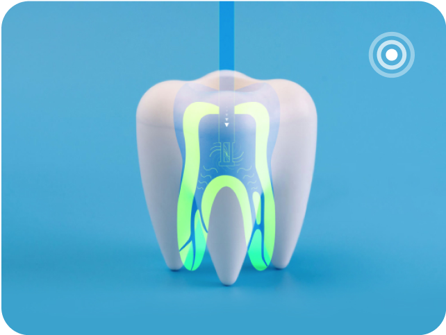 The GentleWave® Experience, Outcomes and Referrals